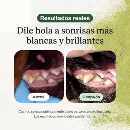 Conozca el galardonado ProBright® Advanced